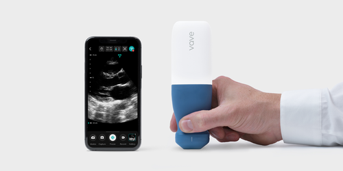 Vave - Ultrasound Untethered | 2019-2020